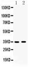 Hydroxysteroid 17-Beta Dehydrogenase 6 antibody, PA5-79406, Invitrogen Antibodies, Western Blot image 