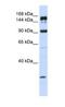 ATP Binding Cassette Subfamily A Member 5 antibody, NBP1-59809, Novus Biologicals, Western Blot image 