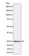 Mitochondrial Ribosomal Protein S15 antibody, M13979-1, Boster Biological Technology, Western Blot image 