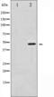 Synaptotagmin 1 antibody, abx011588, Abbexa, Western Blot image 
