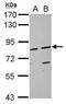 Amine Oxidase Copper Containing 1 antibody, GTX100483, GeneTex, Western Blot image 