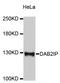 DAB2 Interacting Protein antibody, STJ111748, St John