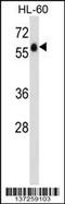 Adhesion G Protein-Coupled Receptor G3 antibody, 58-965, ProSci, Western Blot image 