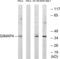 GTPase, IMAP Family Member 4 antibody, abx014509, Abbexa, Western Blot image 