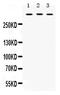 Tenascin XB antibody, PA5-80173, Invitrogen Antibodies, Western Blot image 