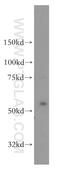 Oxidative Stress Responsive Kinase 1 antibody, 15611-1-AP, Proteintech Group, Western Blot image 