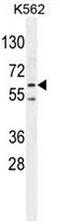 Protein Kinase AMP-Activated Catalytic Subunit Alpha 2 antibody, AP53442PU-N, Origene, Western Blot image 