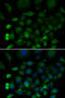 Superoxide Dismutase 3 antibody, MBS129674, MyBioSource, Immunofluorescence image 