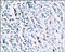 Integrin Linked Kinase antibody, 250718, Abbiotec, Immunohistochemistry paraffin image 