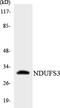NADH:Ubiquinone Oxidoreductase Core Subunit S3 antibody, LS-C200262, Lifespan Biosciences, Western Blot image 