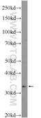 Homeobox D11 antibody, 18734-1-AP, Proteintech Group, Western Blot image 