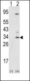 Snail Family Transcriptional Repressor 1 antibody, PA5-11924, Invitrogen Antibodies, Western Blot image 