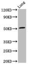 Rho GTPase Activating Protein 1 antibody, LS-C672009, Lifespan Biosciences, Western Blot image 