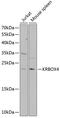 KRAB Box Domain Containing 4 antibody, 22-250, ProSci, Western Blot image 