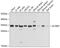 Q86V81 antibody, GTX65947, GeneTex, Western Blot image 