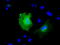 Kelch Repeat And BTB Domain Containing 7 antibody, M14135, Boster Biological Technology, Immunofluorescence image 