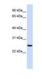 Ubiquitin Conjugating Enzyme E2 K antibody, orb330956, Biorbyt, Western Blot image 