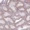 Ribonuclease A Family Member 10 (Inactive) antibody, NBP2-30865, Novus Biologicals, Immunohistochemistry paraffin image 