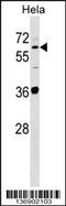 Sulfite Oxidase antibody, 58-907, ProSci, Western Blot image 