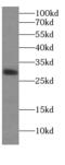 Tubulin Polyglutamylase Complex Subunit 1 antibody, FNab01048, FineTest, Western Blot image 