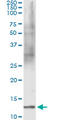 Fatty Acid Binding Protein 1 antibody, LS-C197184, Lifespan Biosciences, Immunoprecipitation image 