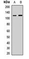 LLGL Scribble Cell Polarity Complex Component 2 antibody, orb412696, Biorbyt, Western Blot image 