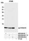 S100 Calcium Binding Protein A16 antibody, A305-655A-M, Bethyl Labs, Immunoprecipitation image 