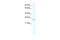 Cysteine Rich Protein 2 antibody, 28-067, ProSci, Western Blot image 