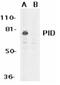 PID antibody, AP05220PU-N, Origene, Western Blot image 