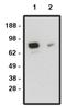 Smoothened, Frizzled Class Receptor antibody, orb109418, Biorbyt, Western Blot image 
