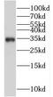 General Transcription Factor IIE Subunit 2 antibody, FNab08631, FineTest, Western Blot image 