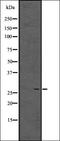 Enkurin, TRPC Channel Interacting Protein antibody, orb336502, Biorbyt, Western Blot image 