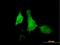 Arachidonate 12-Lipoxygenase, 12S Type antibody, H00000239-B01P, Novus Biologicals, Immunocytochemistry image 