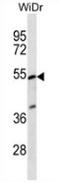 Phosphatidylinositol Glycan Anchor Biosynthesis Class V antibody, AP53301PU-N, Origene, Western Blot image 