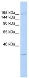 Lysine Demethylase 6A antibody, TA345323, Origene, Western Blot image 