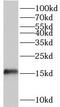 Trafficking Protein Particle Complex 2 Like antibody, FNab08946, FineTest, Western Blot image 