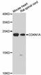 p21 antibody, MBS128120, MyBioSource, Western Blot image 