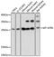 Mitochondrially Encoded ATP Synthase Membrane Subunit 6 antibody, 18-171, ProSci, Western Blot image 