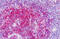 MOB Kinase Activator 1B antibody, MBS248633, MyBioSource, Immunohistochemistry paraffin image 