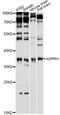 ADP-Ribosylarginine Hydrolase antibody, STJ28199, St John
