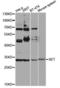 SET Nuclear Proto-Oncogene antibody, LS-C747610, Lifespan Biosciences, Western Blot image 