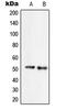 Serine Incorporator 2 antibody, LS-C353685, Lifespan Biosciences, Western Blot image 