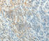 Paxillin antibody, A3065, ABclonal Technology, Immunohistochemistry paraffin image 