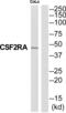 Colony Stimulating Factor 2 Receptor Alpha Subunit antibody, abx015196, Abbexa, Western Blot image 