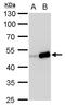 TIMELESS Interacting Protein antibody, GTX129308, GeneTex, Western Blot image 