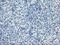 Branched Chain Keto Acid Dehydrogenase Kinase antibody, MA5-24992, Invitrogen Antibodies, Immunohistochemistry frozen image 