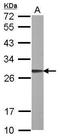 ARF7 antibody, GTX108258, GeneTex, Western Blot image 