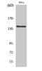 Mov10 Like RISC Complex RNA Helicase 1 antibody, A09677-1, Boster Biological Technology, Western Blot image 