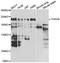 THADA Armadillo Repeat Containing antibody, A07358, Boster Biological Technology, Western Blot image 