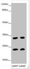 Muscle RAS Oncogene Homolog antibody, LS-C676069, Lifespan Biosciences, Western Blot image 